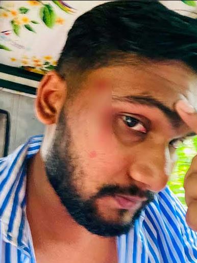 রায়পুরে মাদকবিরোধী প্রতিরোধ করায় ছাত্রদল নেতাকে মারধর